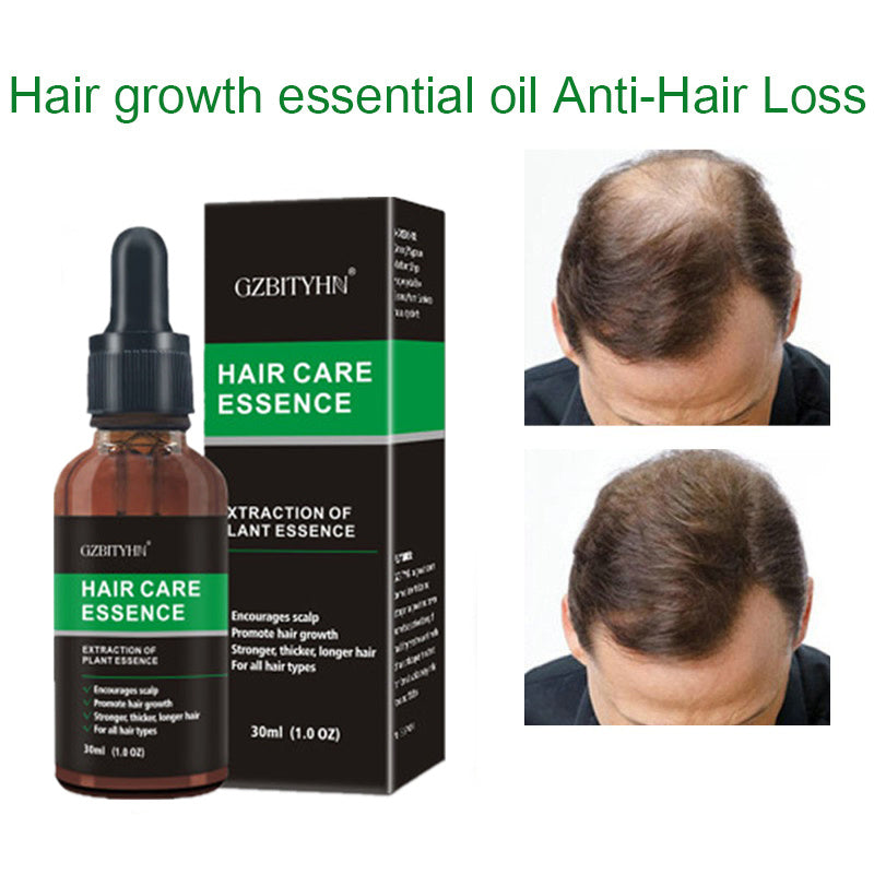 Hair Growth Oil